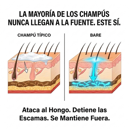 Solución para el Microbioma del Cuero Cabelludo (Spanish)